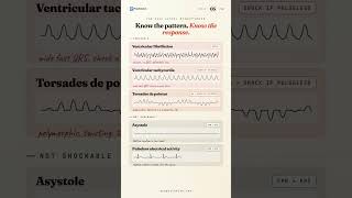 CCRN Exam Practice | Lethal Rhythms | Shock or Don't | PrepSolution