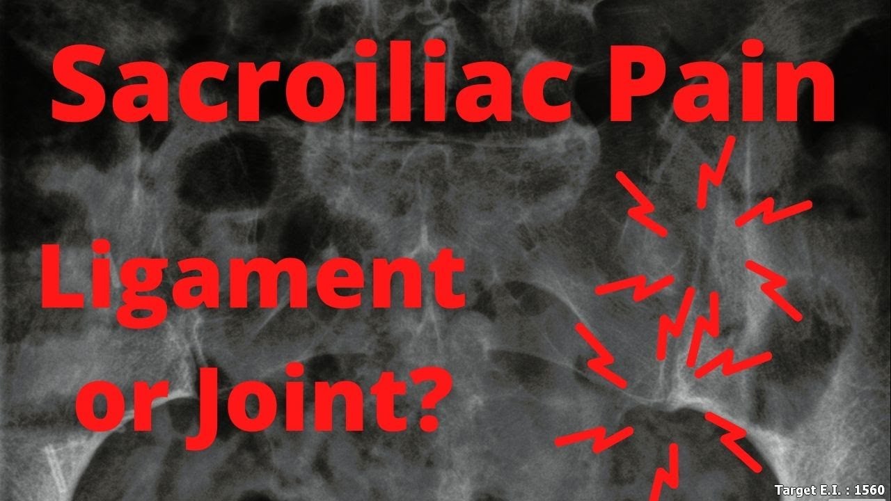 Sacroiliac Joint vs Sacroiliac Ligament | Which Is The Source Of Pain?