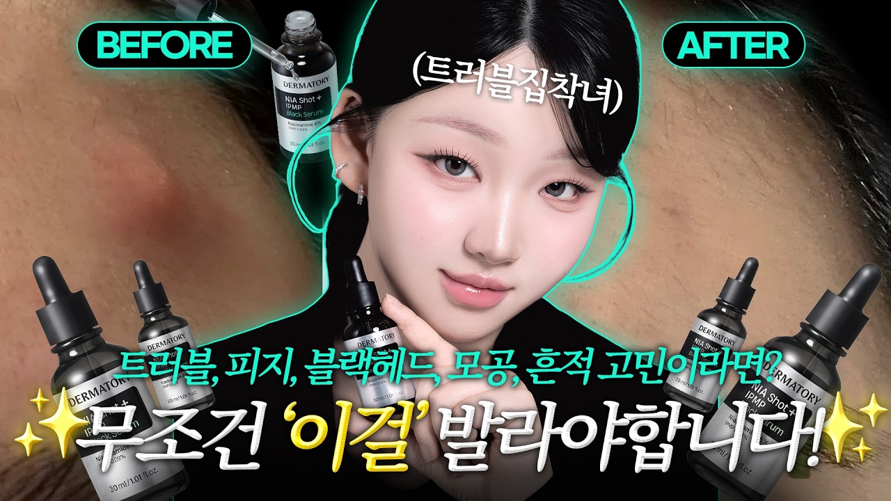 트러블 다 뒤졌다🖤더마토리 톡신 공동개발 트러블 블랙 세럼 탄생🖤피부 고민 싹 케어하는 역작 탄생!! 진짜 제발 써보세요 광명찾음...🔥ㅣ톡신TOXIN