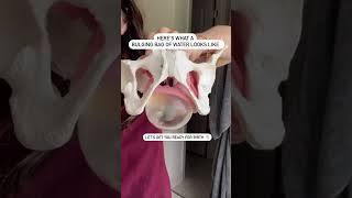 Celebrity Here's What a Bulging Bag of Water Looks Like #shorts #ytshorts #pregnancy Wealth