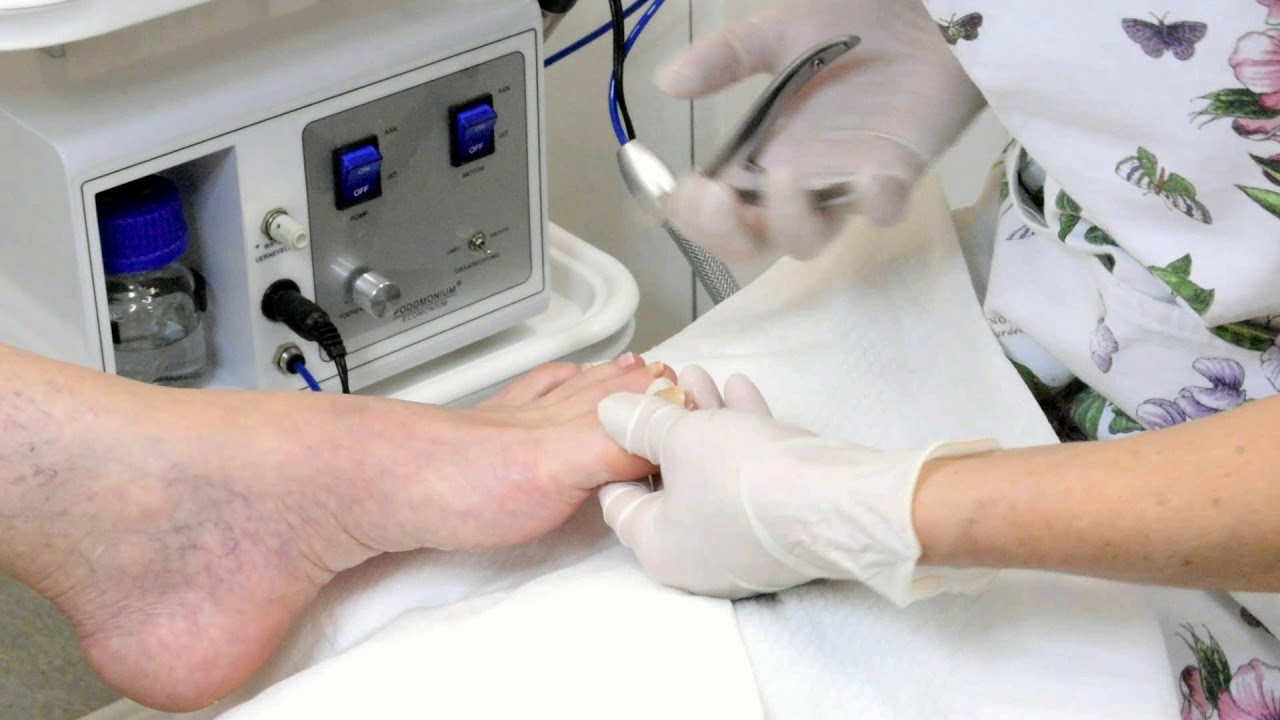 Gyógypedikűr (Hajmánia Szépségszalon)