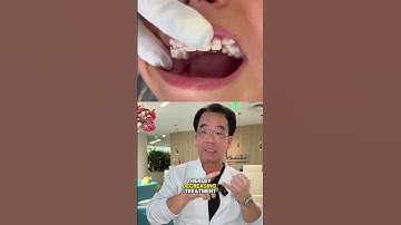 LightForce braces or regular? 😬 #orthodontist #lightforcebraces #braces #orthotips