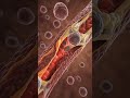 Multiple Myeloma Treatment in Germany