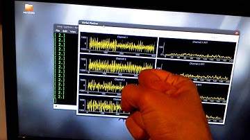 EMG Pattern Recognition