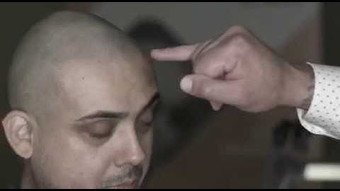 VYTAL Scalp Micropigmentation SMP Device