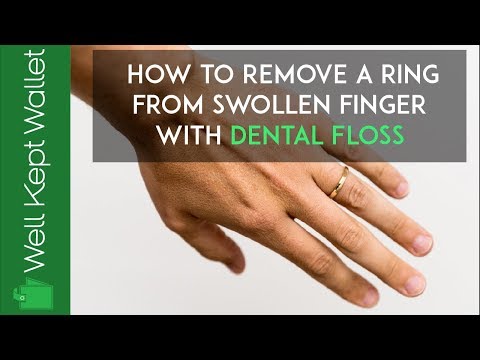 finger remove ring how to How a From Ring Remove Swollen with a to Finger Dental