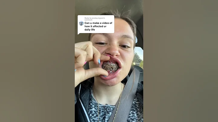 They Wired Her Mouth Shut?! - DayDayNews