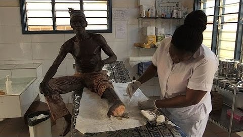 Fighting leprosy when the world thinks it