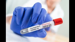 Johnson County COVID-19 Weekly Update 2.22.21