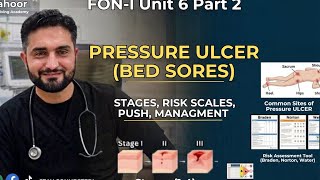 Pressure Ulcer (Bed Sores) Complete Lecture | FON-I Unit 6 Part 2 | Stages, Risk Scales & PUSH Tool