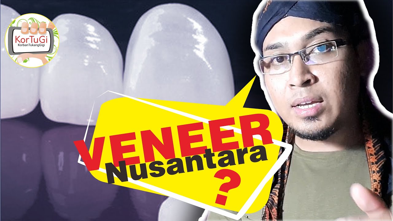 Veneer Gigi Nyambung, Ini Akibatnya YouTube
