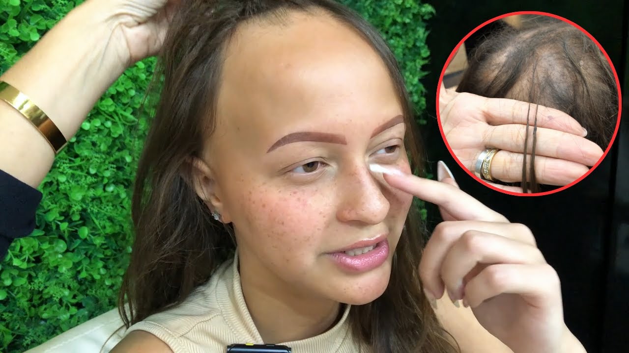 Ela teve que conviver com alopecia a vida Toda! - Trasformação total | Lu Oliveira