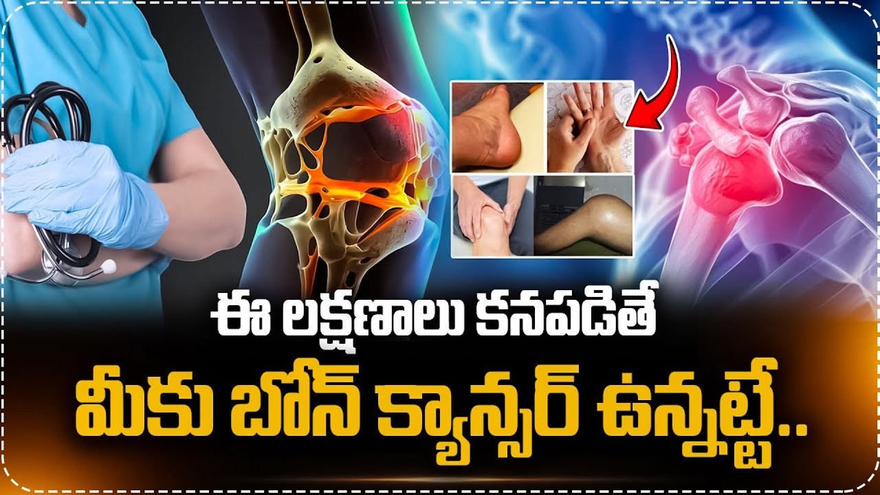 ఈ లక్షణాలు కనపడితే బోన్ క్యాన్సర్ ఉన్నట్టే.. | Bone Cancer Causes and Symptoms in Telugu | Cancer