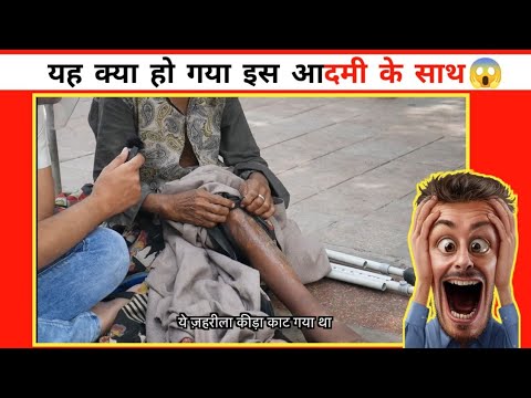 इंसानियत अभी जिंदा है 🔥 | इस आदमी के साथ बहुत बुरा हुआ😥 | amazing facts | #shorts #humanity