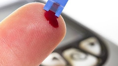 BLOOD TEST: PLATELET AGGREGATION (THROMBOCYTES) in 4K