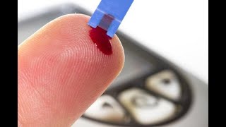 BLOOD TEST: PLATELET AGGREGATION (THROMBOCYTES) in 4K