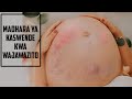 MADHARA YA KASWENDE SYPHILIS KWA MAMA MJAMZITO NA KWA MTOTO TUMBONI MADHARA YA KASWENDE SYPHILIS KWA MAMA MJAMZITO NA KWA MTOTO TUMBONI