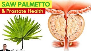 🌿 WARNING: The Nasty Side-Effect of Saw Palmetto Use For Prostate Health (BPH) - by Dr Sam Robbins screenshot 5