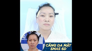 CÙNG BÁC SĨ PHÙNG MẠNH CƯỜNG PHÂN TÍCH VÀ ĐÁNH GIÁ KẾT QUẢ CĂNG DA MẶT SMAS VỪA THỰC HIỆN XONG