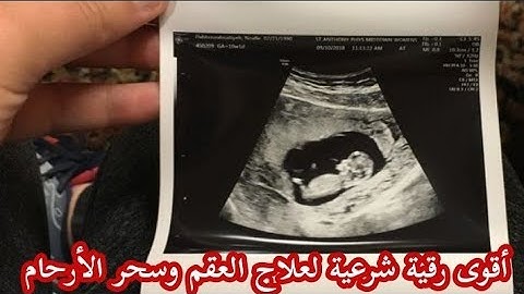 أقوى رقية شرعية للذرية لعلاج العقم وسحر الأرحام لدى الرجال والنساء و حدوث الحمل بإذن الله