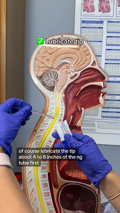 NG Tube Insertion 👃 #RN #BSN #futurenurse