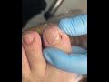 Satisfying Pedicure Routine | Gentle Toenail Care #fypシ #fypシ #pedicure #nailcare