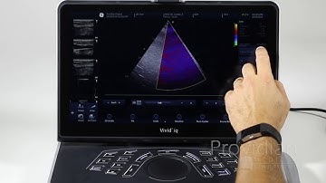 GE Vivid iq Training Part 4: Doppler Modes, Tissue Velocity Imaging (TVI) and Strain Imaging