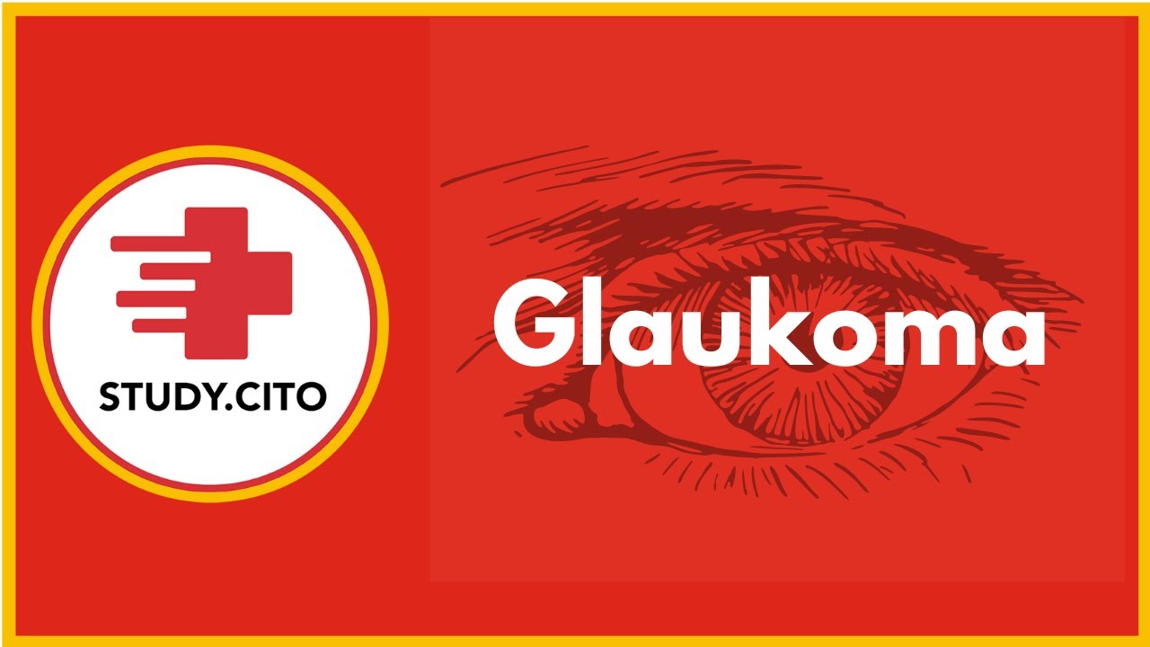 CITO Free Class - Glaukoma