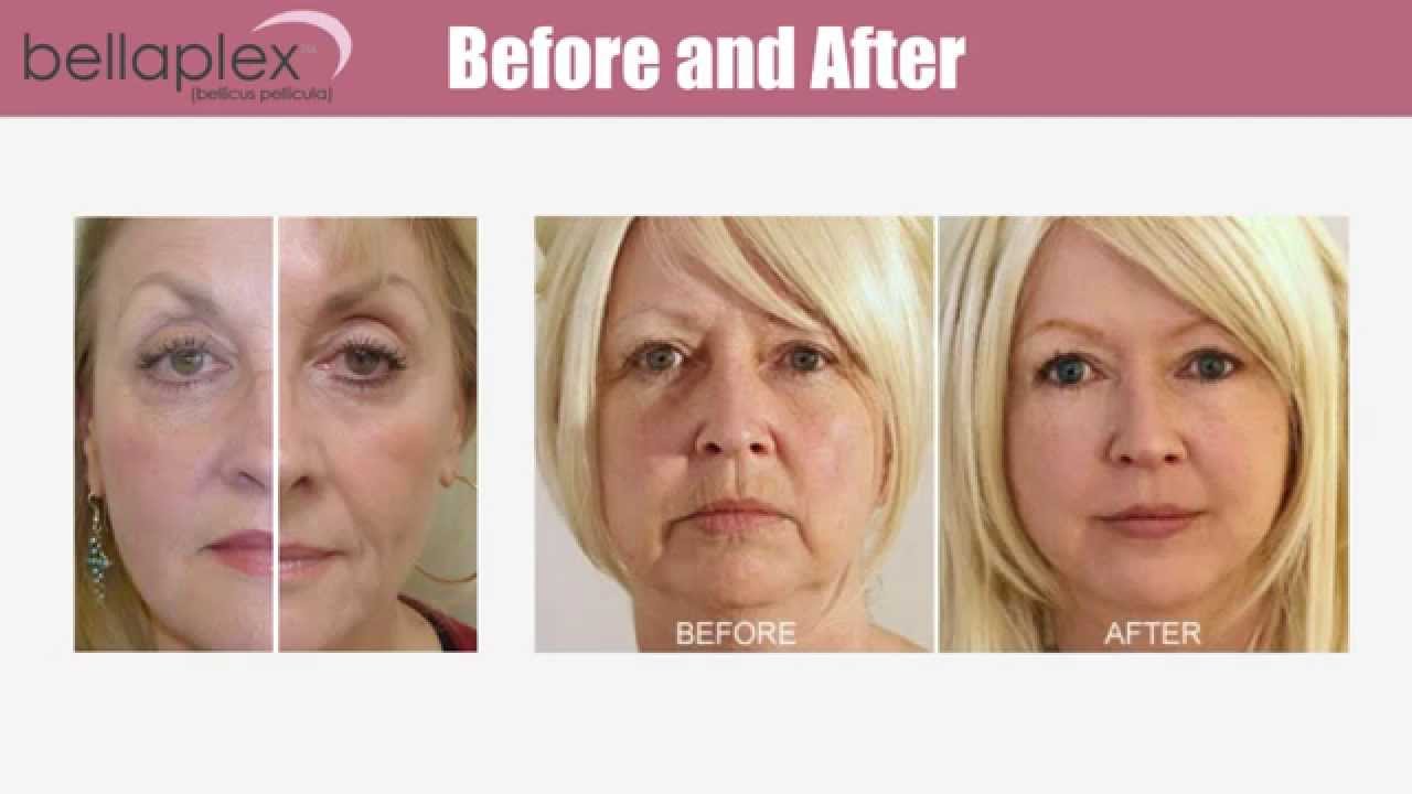 bellaplex