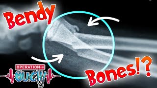 Bendy Bones!? 🦴 | Full Episodes | Operation Ouch