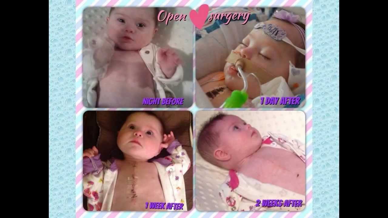 Mended Little Hearts are Special Hearts