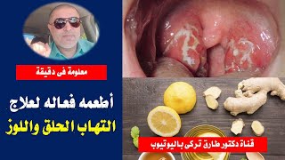 ٨ اطعمه فعاله لعلاج التهاب الحلق واللوز | وداعا لألم والتهاب الحلق وتضخم اللوزتين علاج فعال وطبيعى