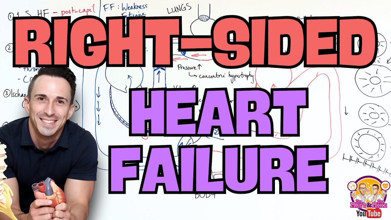 Правосторонняя сердечная недостаточность