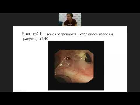 Современные эндоскопические методы в комплексном лечении туберкулеза органов дыхания