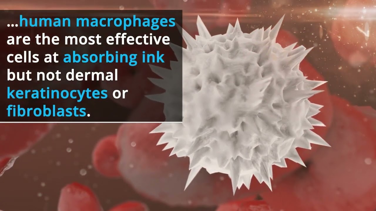 Macrophage-like rapid uptake and toxicity of tattoo ink in human monocytes