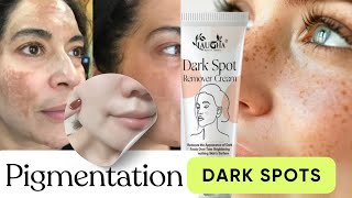How to remove pigmentation from face naturally || black dark spots on face removal cream 