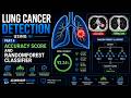 Lung Cancer Detection Using AI Part 4: Accuracy Score and RandomForestClassifier