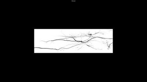 Comprehensive Review in Vascular and Endovascular Medicine - Video 16.1a