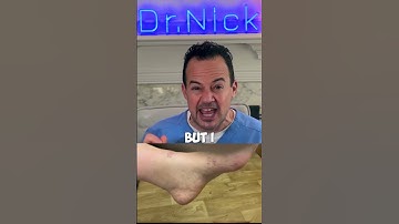 How long does it take to recover from bunion surgery? #shorts