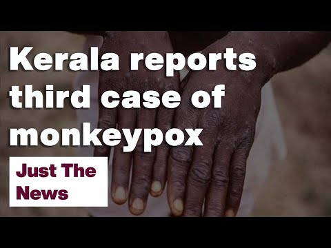 Kerala reports third case of monkeypox: Just The News: 22-07-2022