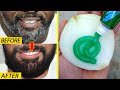 White beard to black beard naturally in Just 4 minutes is always 100% working at home