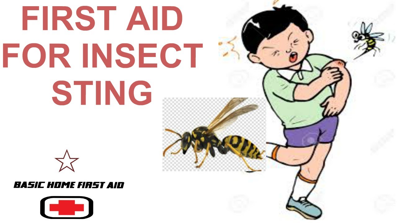 How to treat an insect sting
