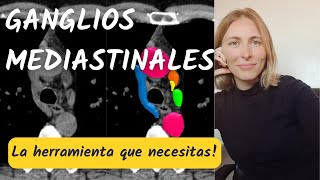 ¡Ganglios mediastinales por TC! La herramienta que necesitas para aprenderlos en tiempo record ⏲️