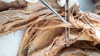 Posterior cord of Brachial plexus - Formation,  Branches and Distribution and Clinical Anatomy