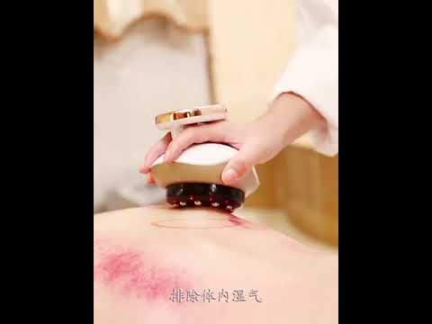 Electric Cupping Stimulate Acupoint Body Slimming Massager Guasha Scraping Detoxification Therapy