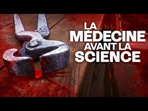 Les Remèdes Médicaux Inattendus Du Haut Moyen Âge