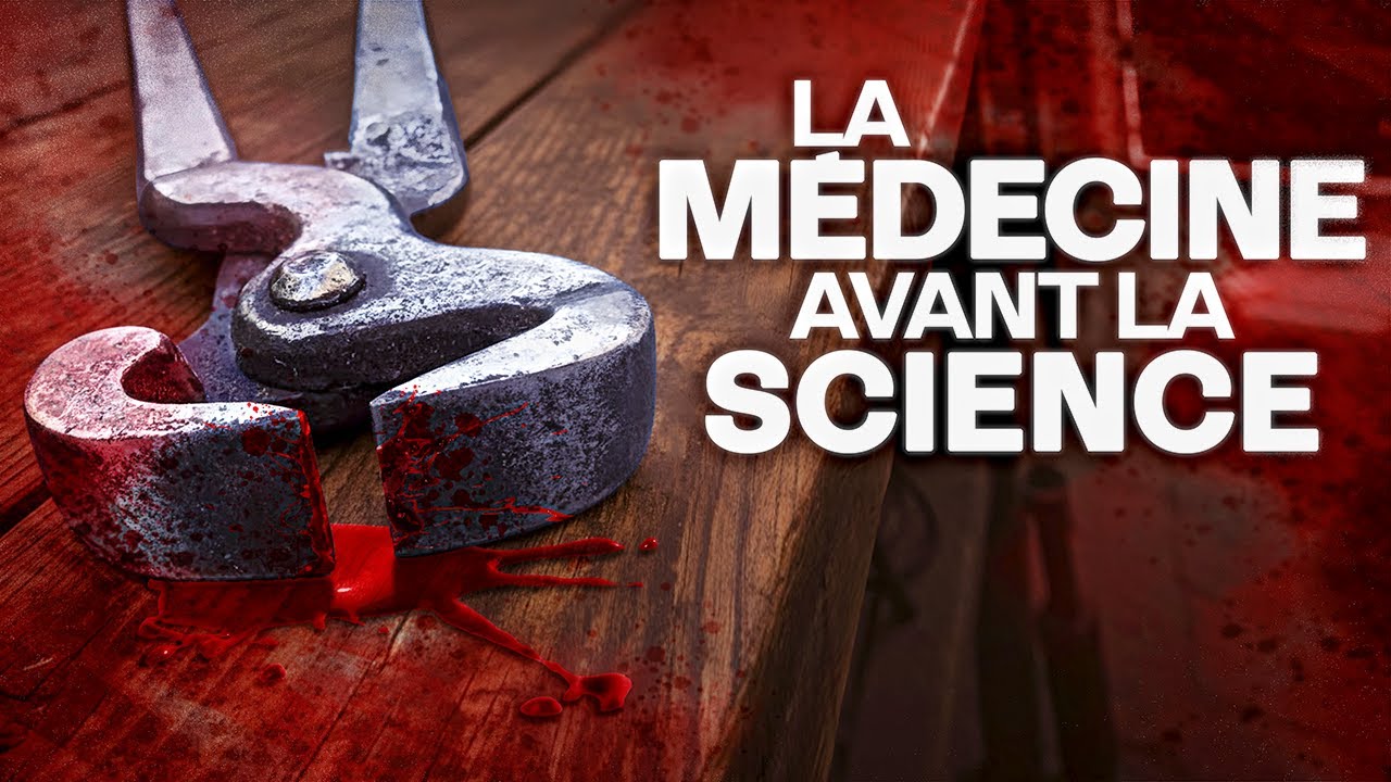 Une médecine douteuse mais efficace au Haut Moyen Âge ?