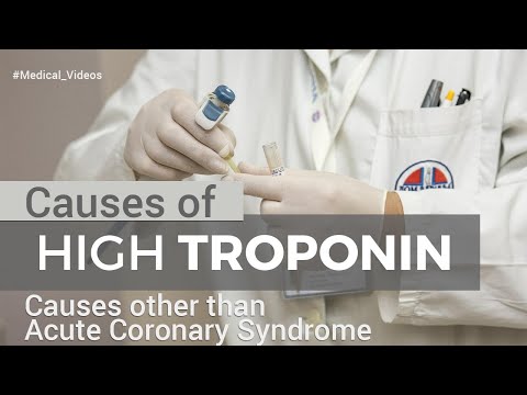 Video: Crește nivelul de troponine cu angina pectorală?