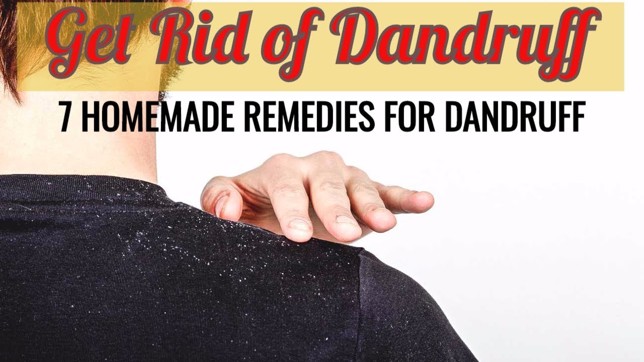 Get Rid of Hair Dandruff |  7 homemade natural solutions for Dandruff - YouTube