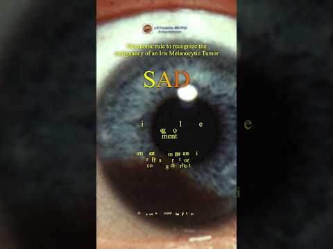 Video: Maligna neoplasmer i ögat